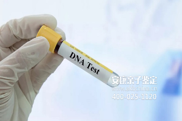 临沧临沧DNA做亲子鉴定需要多少钱 